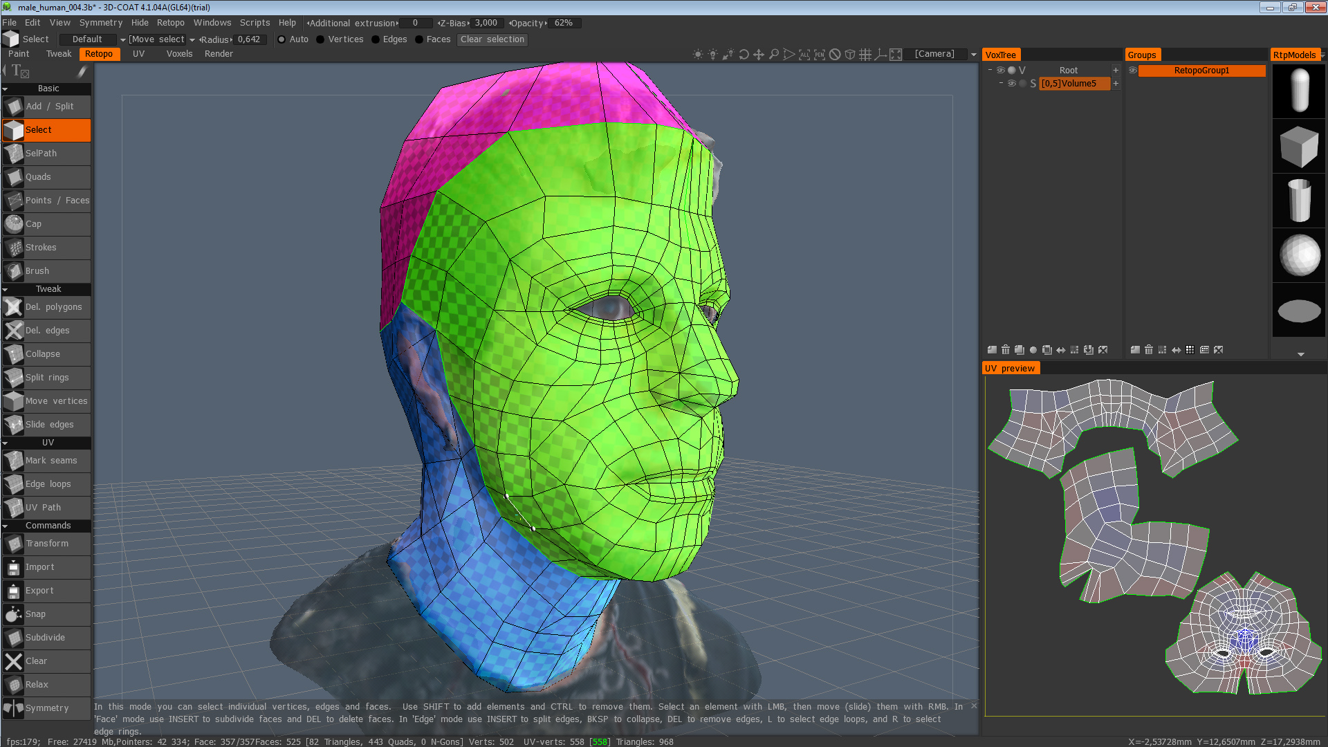 Head Topology 3